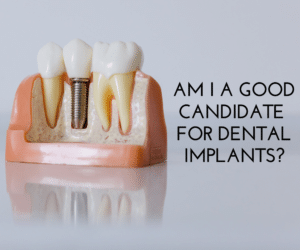 Am I A Good Candidate For Dental Implants