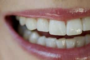 Cosmetic Dentistry for Chicago Recovers Teeth Gone Gray 657377cbc4e76.jpeg