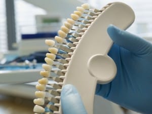 How Does Teeth Whitening Work?— Chicago Dental Experts 6573779fb25c8.jpeg