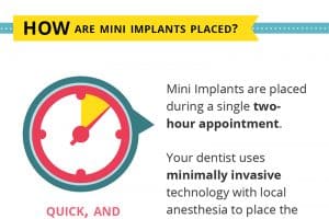 mini implants infographic 300x200